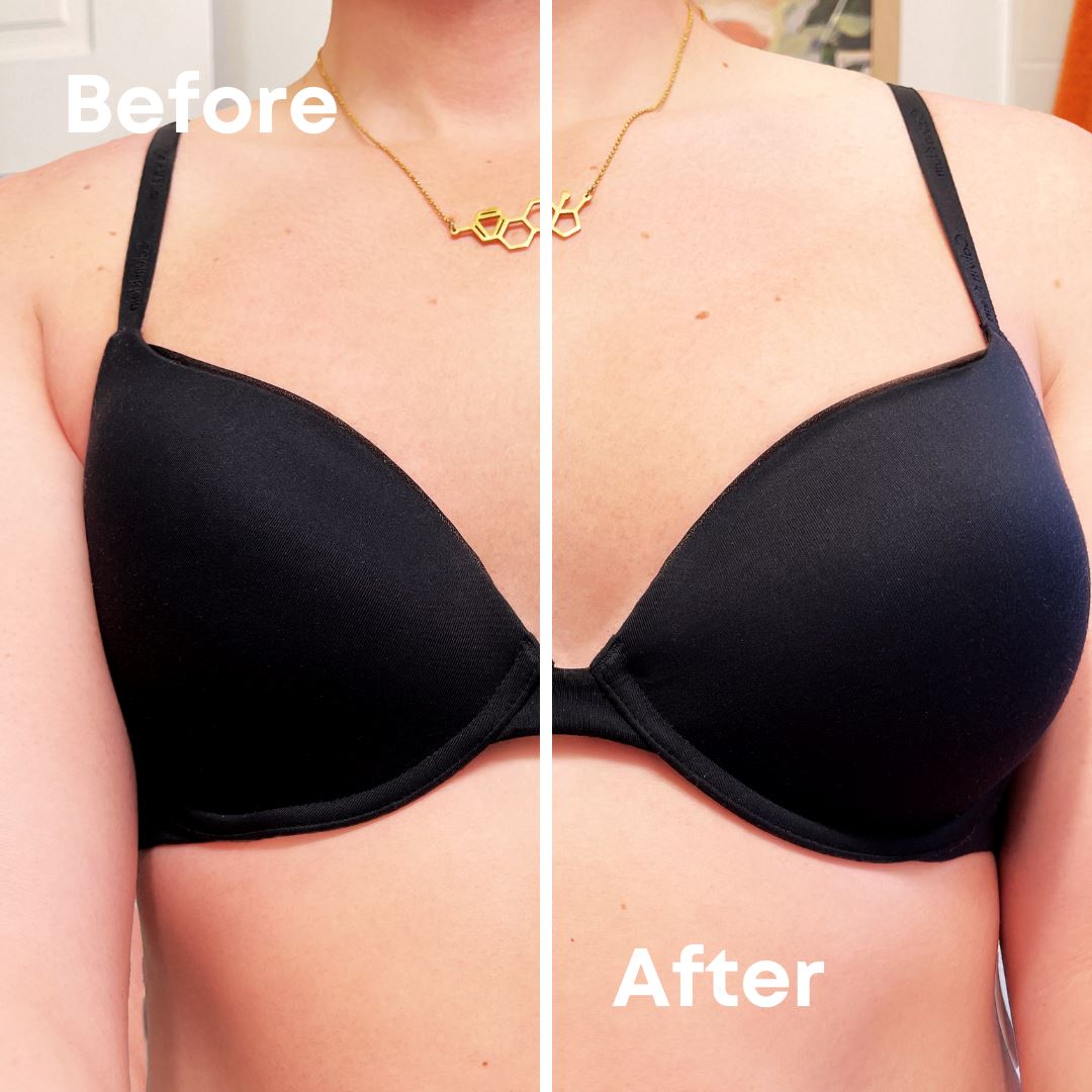 Differences in breast and bra issues pre-post BT (n ¼ 33